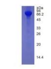 Active Mannose Binding Lectin (MBL)