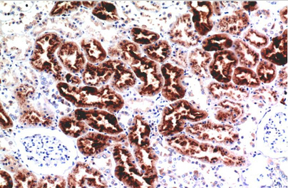 Cystatin C Mouse Monoclonal Antibody(7F11)