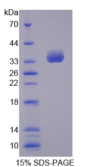 Recombinant Tubulin Folding Cofactor B (TBCB)