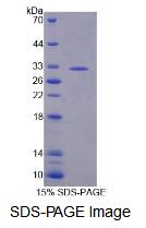 Recombinant Beta-1,3-Glucuronyltransferase 2 (b3GAT2)