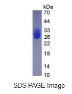 Eukaryotic Interleukin 6 (IL6)