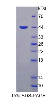 Recombinant Homeodomain Interacting Protein Kinase 4 (HIPK4)