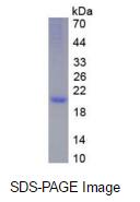 Eukaryotic Growth Hormone (GH)