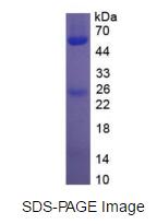 Eukaryotic Immunoglobulin G (IgG)