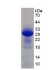 Active Interleukin 2 Receptor Beta (IL2Rb)