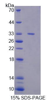 Recombinant Guanylate Binding Protein 1, Interferon Inducible (GBP1)