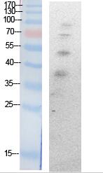 Ub (Acetyl Lys27) Polyclonal Antibody