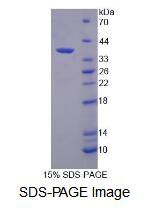 Recombinant Splicing Factor 1 (SF1)