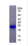 Active Interleukin 1 Receptor Type I (IL1R1)