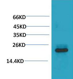 HSPB8/HSP22 Monoclonal Antibody