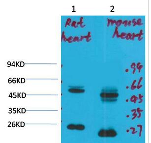 Kv1.8 Polyclonal Antibody
