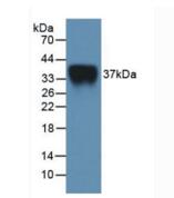 Active Interleukin 2 Receptor Alpha (IL2Ra)