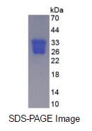 Eukaryotic Oncostatin M (OSM)