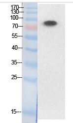 Ub (Acetyl Lys33) Polyclonal Antibody