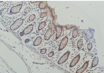 Galectin-3 Monoclonal Antibody