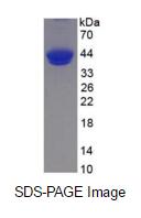 Eukaryotic Complement Component 5a (C5a)