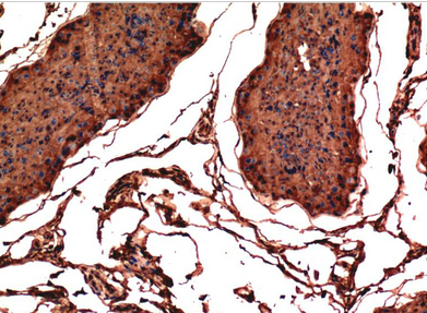 Bax Mouse Monoclonal Antibody(1C1)