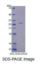 Recombinant Replication Factor C5 (RFC5)