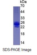 Eukaryotic Interleukin 1 Receptor Antagonist (IL1RA)