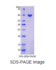 Recombinant Follicle Stimulating Hormone (FSH)