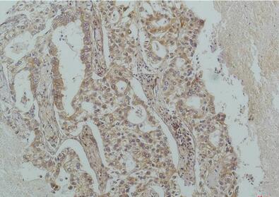 IκB β Monoclonal Antibody