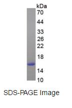 Eukaryotic Fatty Acid Binding Protein 4, Adipocyte (FABP4)