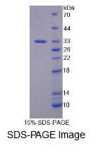 Recombinant Splicing Factor 3B Subunit 1 (SF3B1)