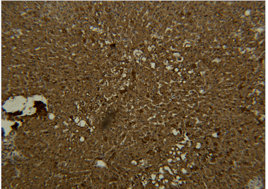 Transferrin Monoclonal Antibody