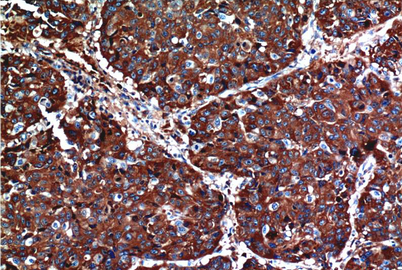 AKT Mouse Monoclonal Antibody(1H2)