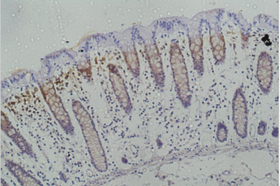 Galectin-3 Monoclonal Antibody