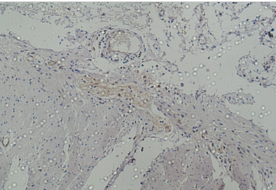Galectin-3 Monoclonal Antibody