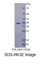 Recombinant Hippocalcin (HPCA)