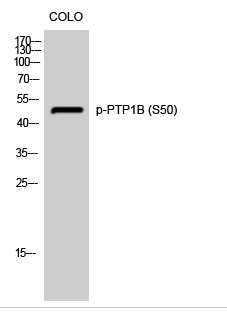 PTP1B (phospho Ser50) Polyclonal Antibody