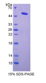 Recombinant Lysyl Oxidase (LOX)