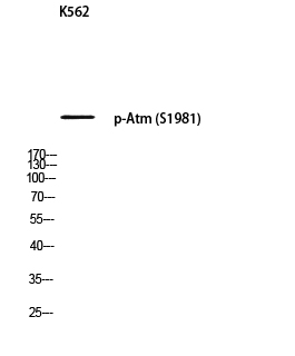 Atm (phospho Ser1981) Polyclonal Antibody