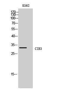 CIB3 Polyclonal Antibody