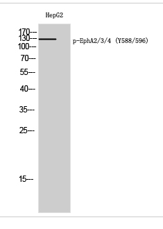 EphA2/3/4 (phospho Tyr588/596) Polyclonal Antibody