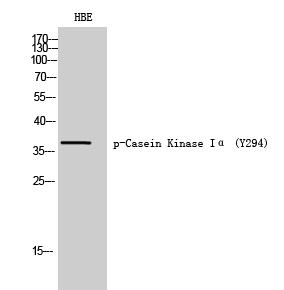 Casein Kinase Iα (phospho Tyr294) Polyclonal Antibody