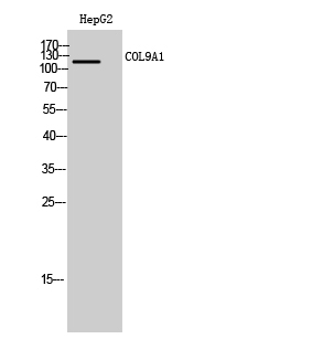 COL9A1 Polyclonal Antibody