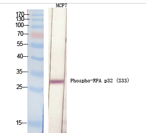 RPA p32 (phospho Ser33) Polyclonal Antibody