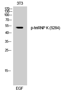 hnRNP K (phospho Ser284) Polyclonal Antibody
