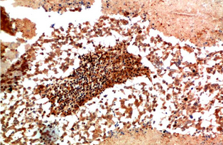 JAK1 Rabbit Polyclonal Antibody