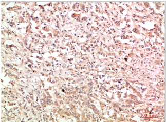 c-Abl Rabbit Polyclonal Antibody