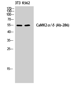 CaMKIIα/δ Polyclonal Antibody
