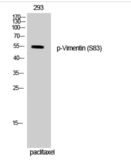 Vimentin (phospho Ser83) Polyclonal Antibody