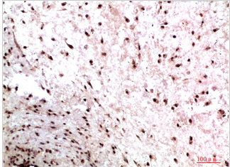 HP-1γ Mouse Monoclonal Antibody(2F5)