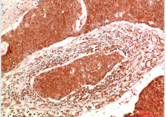 JAK2 Mouse Monoclonal Antibody(9B4)
