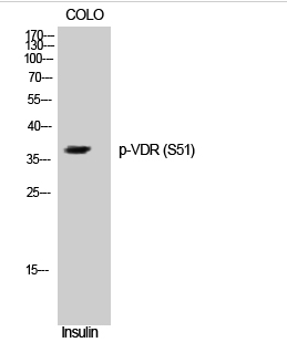 VDR (phospho Ser51) Polyclonal Antibody