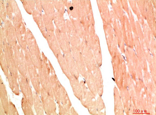 NBR1 Rabbit Polyclonal Antibody