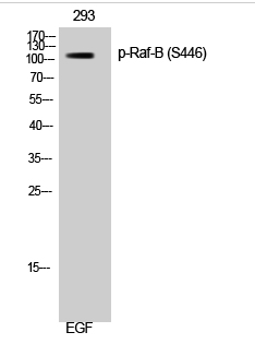 Raf-B (phospho Ser446) Polyclonal Antibody